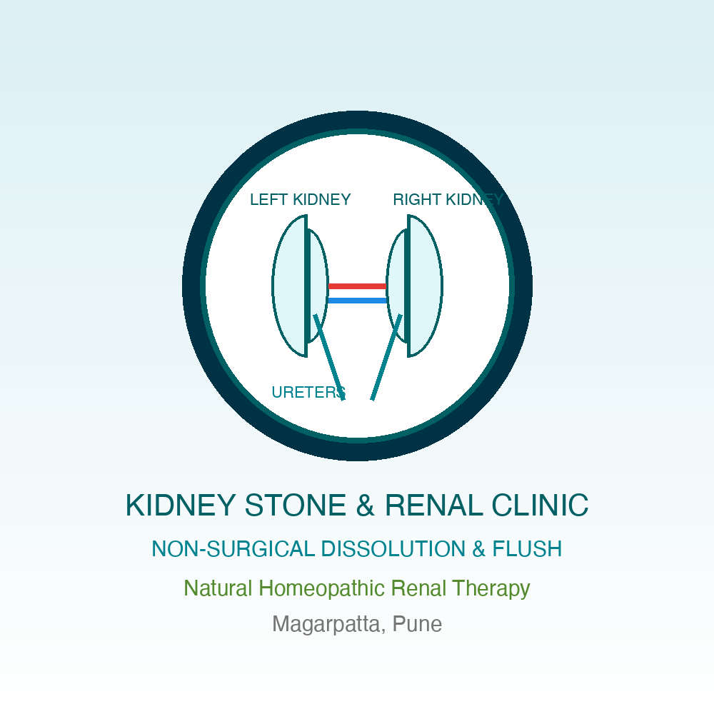 Top Kidney Stone Doctor in Magarpatta, Pune